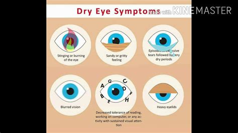 Dry Eyes Causes Symptoms Prevention And Treatment Youtube