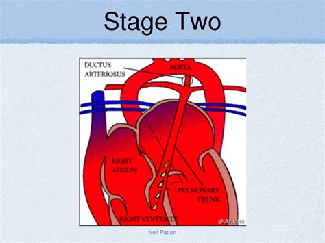 Ppt Fetal Circulation Powerpoint Presentation Free Download Id5388525