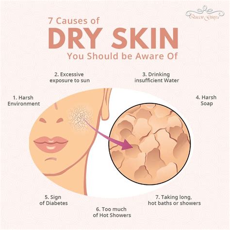 No One Likes To Have Dry Skin Do You Thats Why It Is Essential To Know What Causes It To