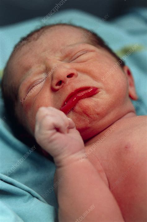 Newborn Baby Crying Stock Image M8100243 Science Photo Library