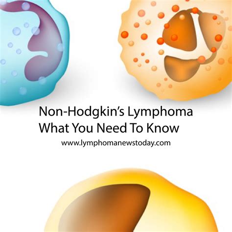 All You Need To Know About Non Hodgkins Lymphoma