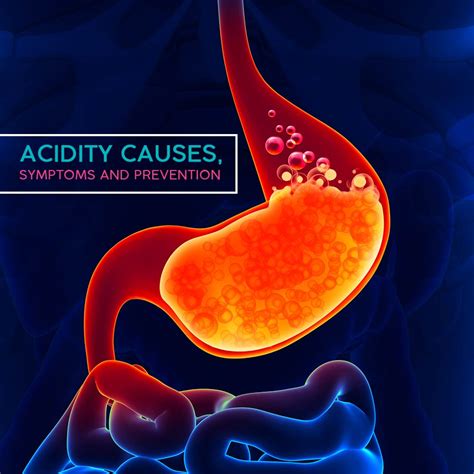 Acidity In Stomach