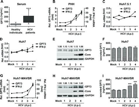 Gp73 Expression Is Activated And Correlated With Ifn Activation During