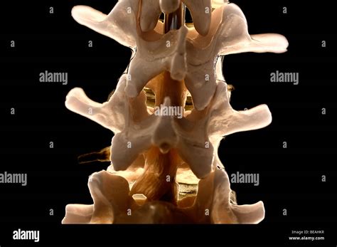 Primer Plano De Una Columna Vertebral Humana Mostrando Las Vértebras
