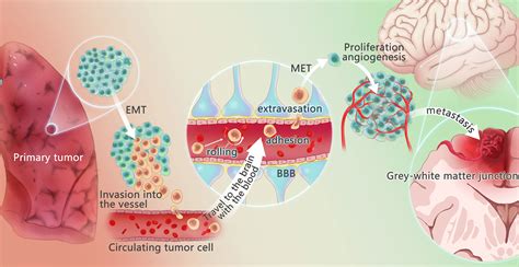 Frontiers Tumor Immune Microenvironment And Immunotherapy In Brain
