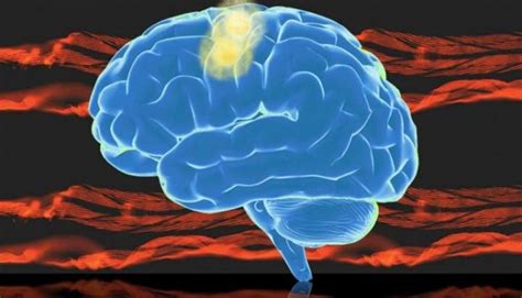 Progressive Brain Disease Cte Confirmed As Unique Disease