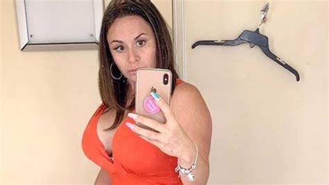 Botched Cosmetic Surgery In Colombia Nearly Kills Florida Woman Latest