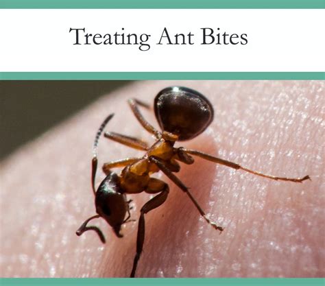 Ant Bites And How To Treat Them The Pest Advice