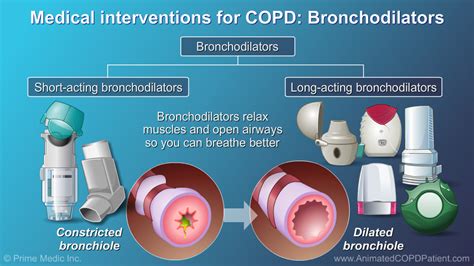 Slide Show Management And Treatment Of Copd
