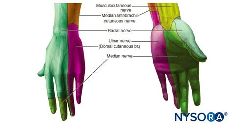 Wrist Block Landmarks And Nerve Stimulator Technique Nysora