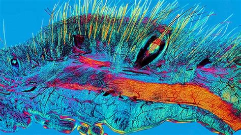 Almost all of our things fall into the cat's fur. Cat Hair Follicle Under Microscope - Micropedia