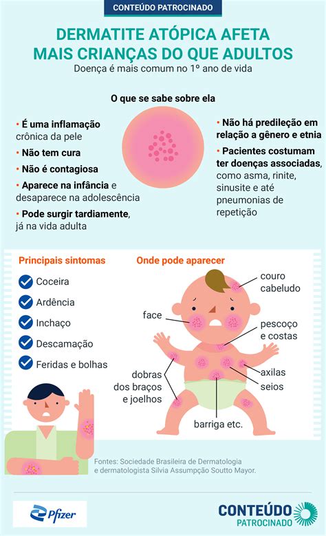 Aprender Sobre 94 Imagem Dermatite Atópica Infantil Fotos Br