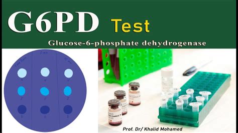 Glucose 6 Phosphate Dehydrogenase Test G6pd Youtube