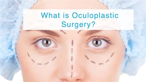 Oculoplastic Surgery Types Recovery Time Cost Sutured