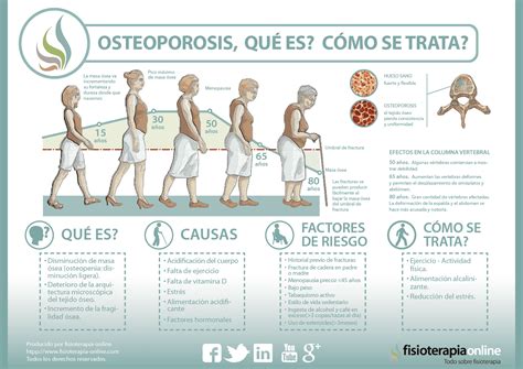 Descubre Qué Es Y Cómo Se Trata La Osteoporosis U Osteopenia Fisioonline