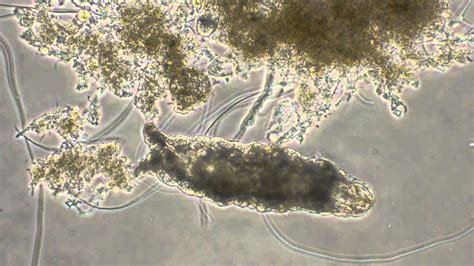 Activated Sludge Microscopic Exam Tardigrade Type 021n