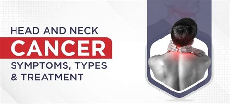 Head And Neck Cancer Symptoms Types And Treatment