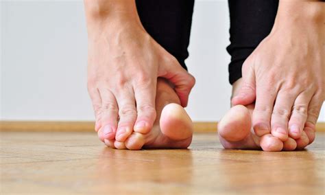 splay foot symptoms and treatment exercises footfiles