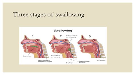 3 Stages Of Swallowing Atlantic Ear Nose And Throat