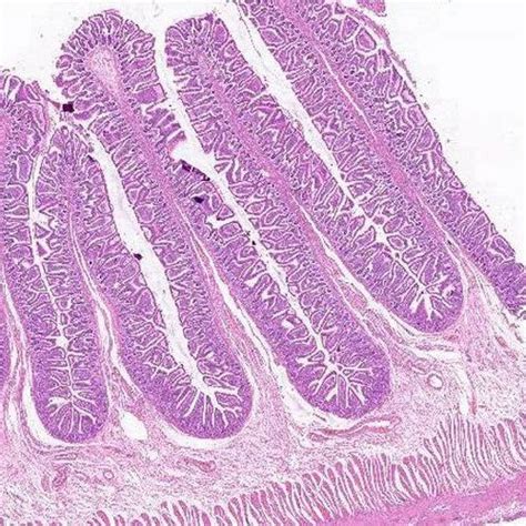 Small Intestine Histology Ileum Labels Histology Slide The Best Porn