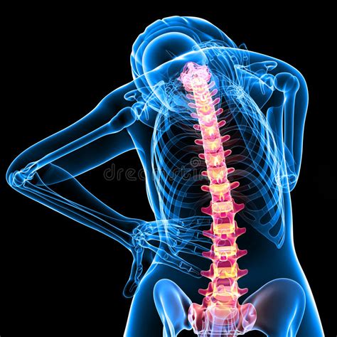 The spine has two natural curves: Posterior View Of Female Skeleton With Back Pain Stock Illustration - Illustration of stress ...