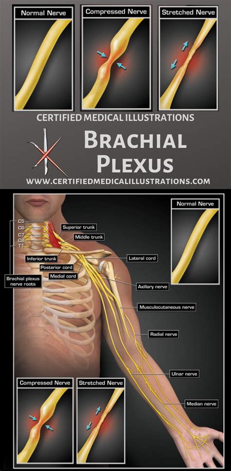 Brachial Plexus Print Quality Instant Download Brachial Plexus