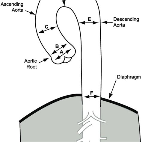 This Diagram Of The Thoracic Aorta Demonstrates The Segments Used For