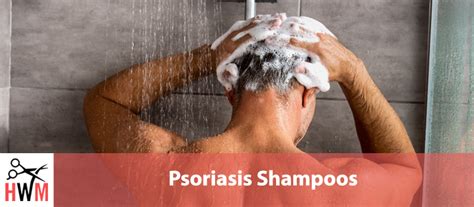 10 Best Shampoos For Psoriasis Hair World Magazine