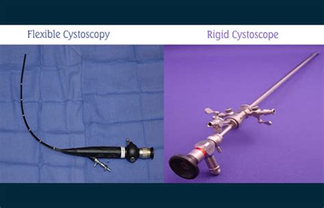 Cystoscopy Treatment And Surgery Treatment For Cyst