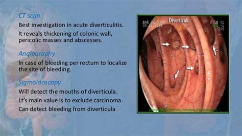 Narrowing Stricture In The Colon Or Fistula Formation As Related To