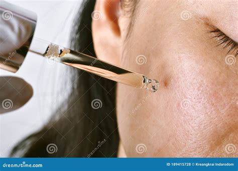 Dermatologist Doctor Examines A Birthmark Of Patient Stock Photo