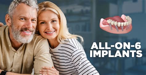 All On 6 Implants Grandview Dental Care Thornhill