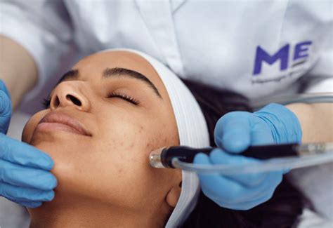 Microderm Infusion And Microdermabrasion Facial Near You
