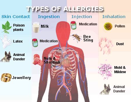 What Is Allergy Jiva Health Multi Specialty Medical Clinic California