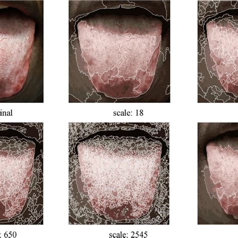 Full Article Advances In Automated Tongue Diagnosis Techniques