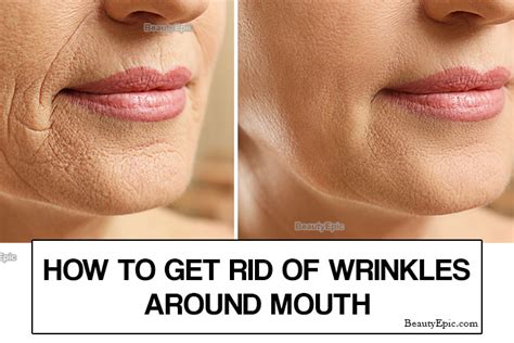 How To Reduce Wrinkles Around The Mouth Naturally