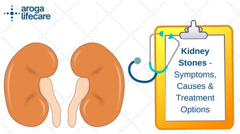 Causes Of Kidney Stones Causes Of Kidney Stonescauses Of Kidney Stones