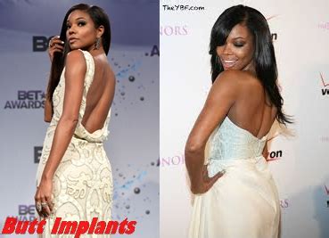 Gabrielle Union Plastic Surgery Before And After Photos