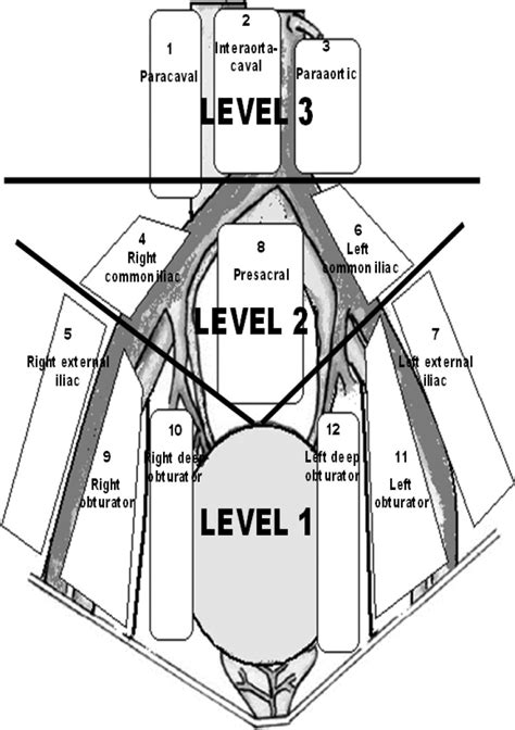 Diagram Neck Lymph Node Levels Diagram Mydiagramonline
