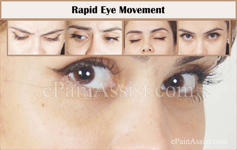 Rapid Eye Movement Rem Sleep Behavior Disorderteststreatment