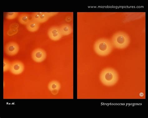 Colony Morphology Of Streptococcus Pyogenes Beta Hemolytic Group A