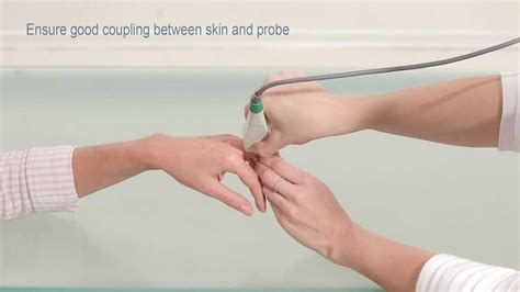 Osteoporosis Assessment by Measuring the Phalanx 