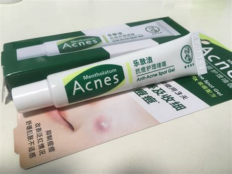 Shuqing's Story: Beauty Review: Mentholatum Acnes