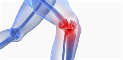 PRP Therapy For Chronic Knee Pain Masri Sports Medicine And Wellness