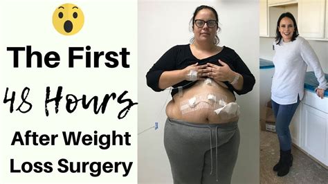 First Hours After Vsg What Happened Gastric Sleeve Surgery Youtube