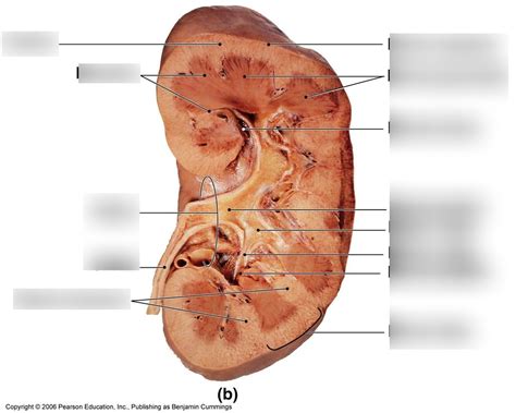 Kidney Dissection Diagram Quizlet