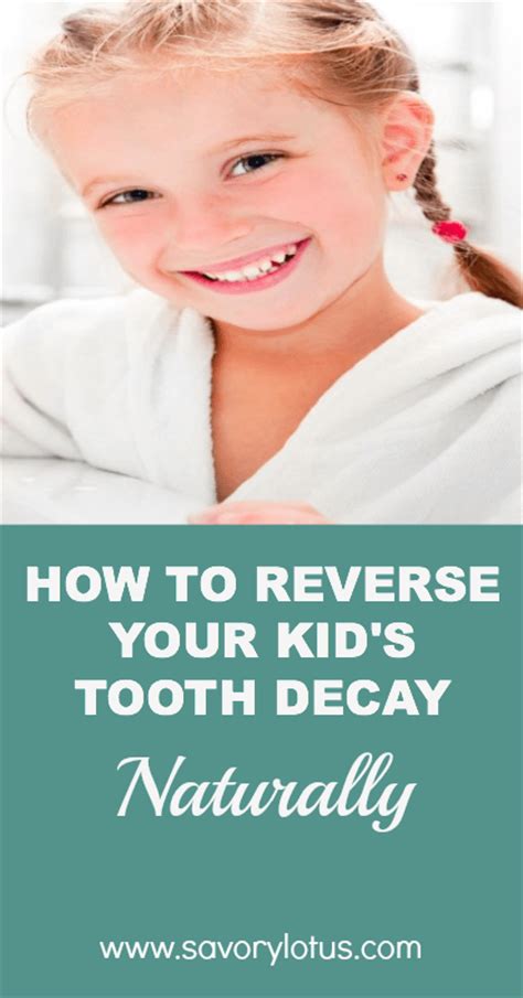 When you do, you potentially gain much more than just the knowledge to reverse tooth decay. How to Reverse Your Kid's Tooth Decay Naturally - Savory Lotus