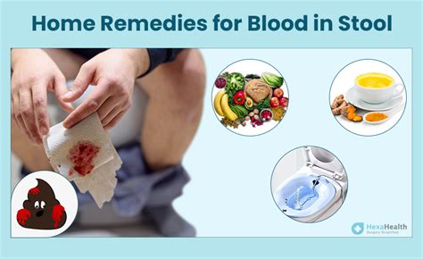 managing anal bleeding tips for relief ask the nurse expert