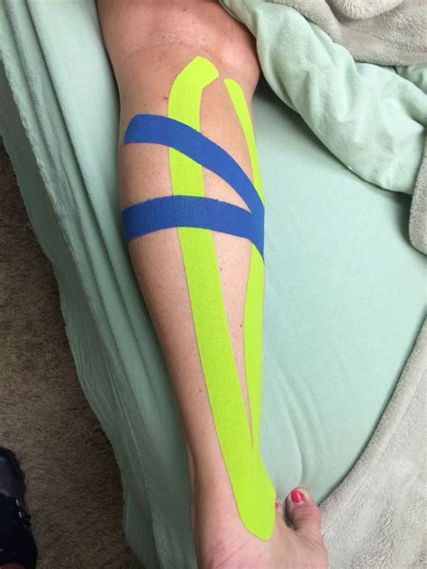 Medial Gastrocnemiuscalf Pulled Muscle Relief And Support Rocktape