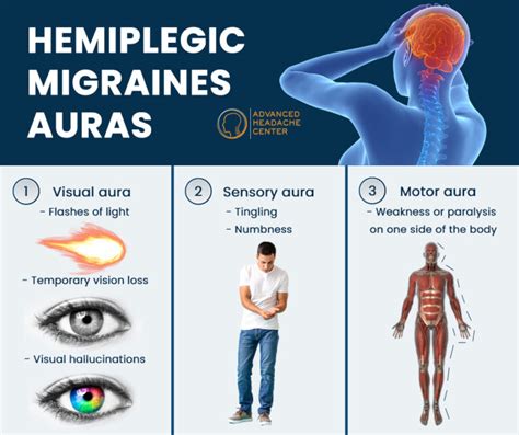 Hemiplegic Migraine Treatment Specialist In Nyc And Nj Advanced